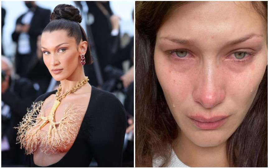 Bella Hadid despre lupta ei cu depresia: Știu că nu asta vor să vadă oamenii pe Instagram
