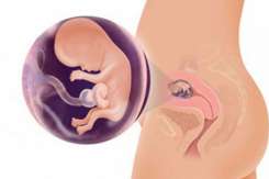 Medic obstetrician-ginecolog: Cele mai importante riscuri și pericole din primul trimestru de sarcină