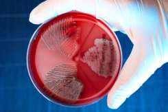 Infecția cu streptococ de grup B în sarcină: Riscuri, testare și prevenție