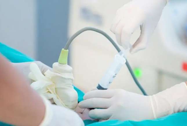 Amniocenteza în sarcină: cât de sigură este și când este recomandată