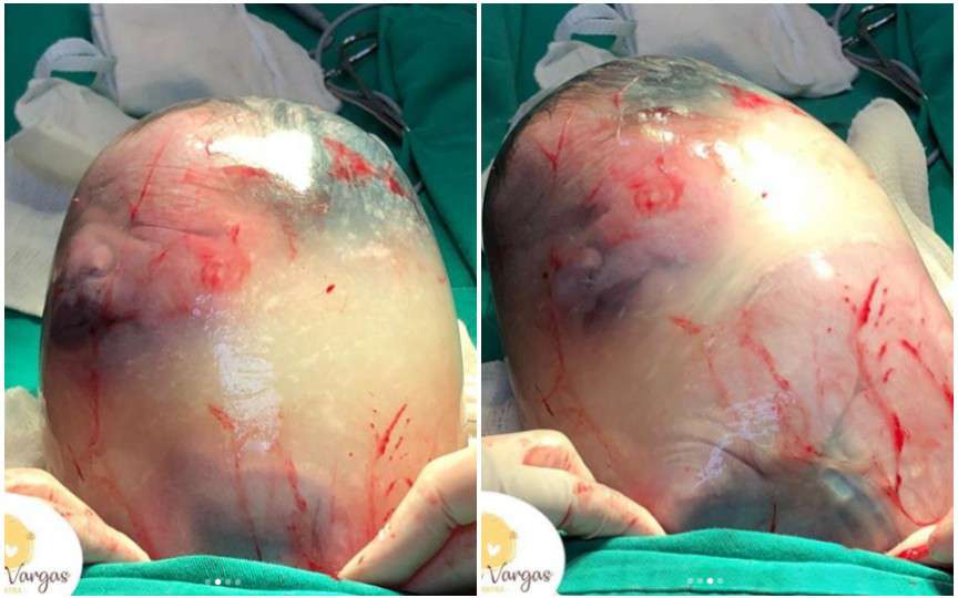 Importanța lichidului amniotic în evoluția sarcinii. Când trebuie să ne îngrijorăm?