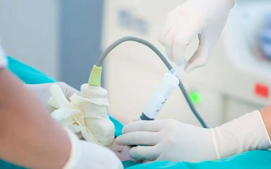 Amniocenteza în sarcină: cât de sigură este și când este recomandată