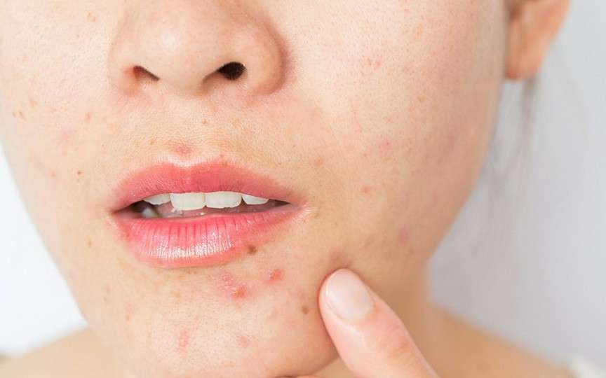 Avertisment medical: Rutinele de skincare promovate pe TikTok pot afecta grav pielea adolescenților
