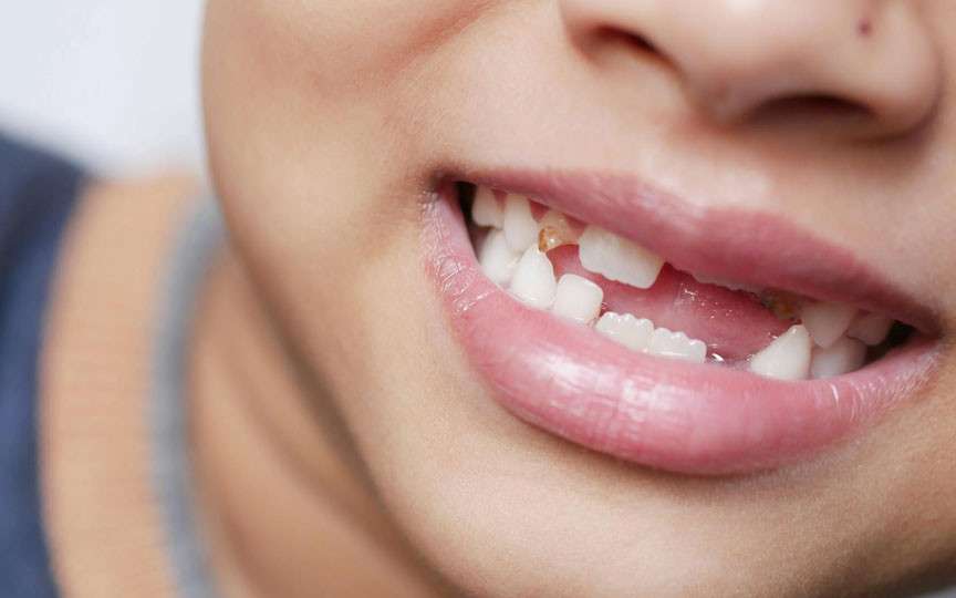 Regenerarea dinților lipsă: Un medicament revoluționar intră în teste clinice