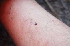 Boala rară transmisă de căpușe care dă fiori la începutul sezonului cald
