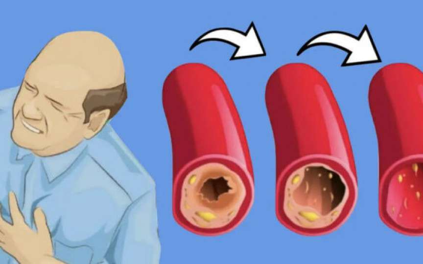 15 Alimente care vă vor curăța arterele și vă vor proteja de atacul de cord
