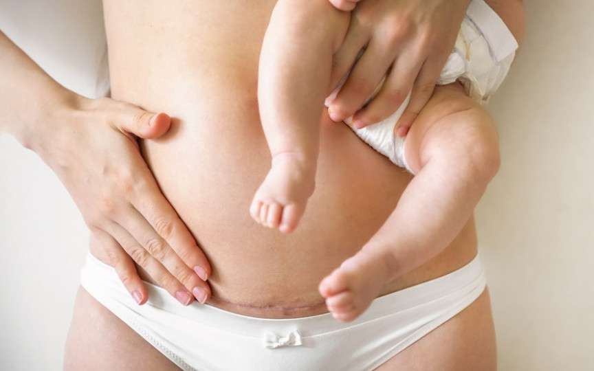 Cât timp trebuie să treacă de la cezariană până la conceperea unui alt copil?