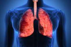 Cum ne afectează pneumonia și de ce este atipică cea provocată de COVID-19