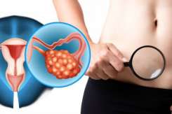4 Simptome ale cancerului ovarian pe care fiecare femeie trebuie să le cunoască