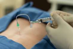 Anestezia epidurală vs. anestezia spinală