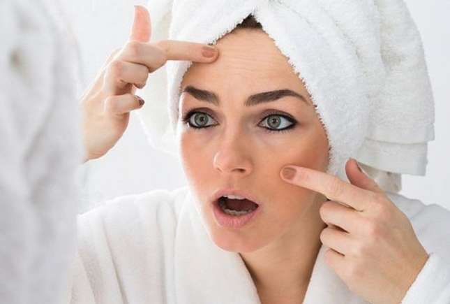 Este dermatita seboreică o problemă medicală cu care se poate trăi?