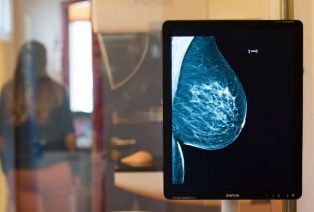 Mamografia – o necesitate. Vezi unde găsești la noi unicul utilaj de ultimă generație pentru mamografie!