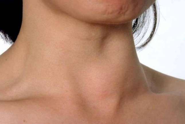 Cel mai evident simptom al lipsei de iod din organism - cauza bolilor de tiroidă