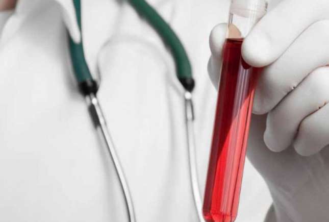 Testarea bilirubinei poate arăta prezenţa acestor boli