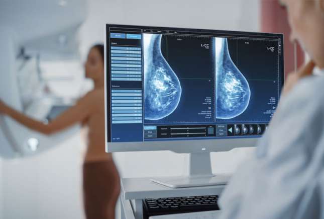 Cancerul de sân: O realitate care nu trebuie ignorată! Când și cum să te testezi