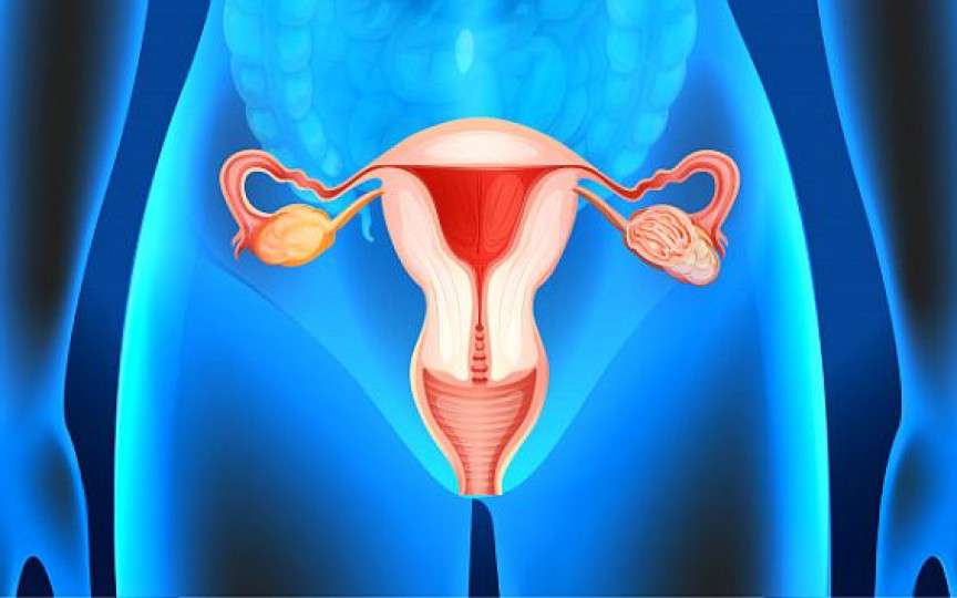 Chisturile uterine: când apar și cum pot fi eliminate