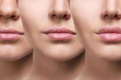 Cum îți influențează hormonii pielea: ghid complet pentru pubertate, sarcină și menopauză