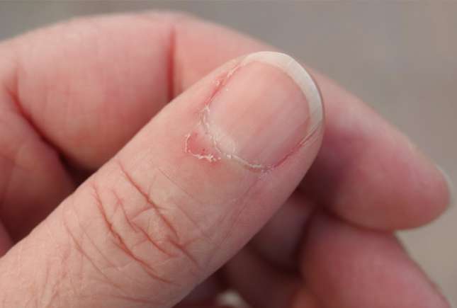Uleiul natural din bucătărie care vindecă cuticulele uscate în doar 10 minute