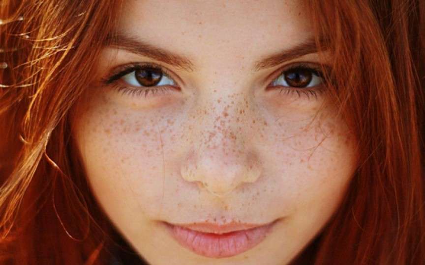 Pistruii  - complex sau mândrie? Află de la cosmetologa Natalia Spătaru cauza apariției lor și cum pot fi camuflați