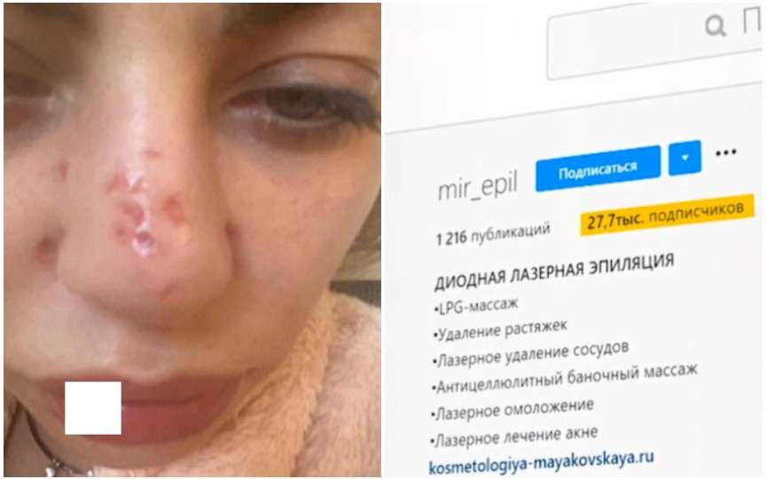 O femeie amenință cu judecata o esteticiană după ce i-a deteriorat pielea