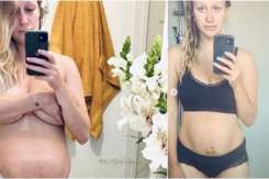 Confesiunea dureroasă a unei mame: Nimeni nu te pregătește pentru perioada postpartum după o pierdere de sarcină