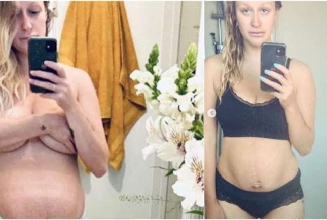 Confesiunea dureroasă a unei mame: Nimeni nu te pregătește pentru perioada postpartum după o pierdere de sarcină