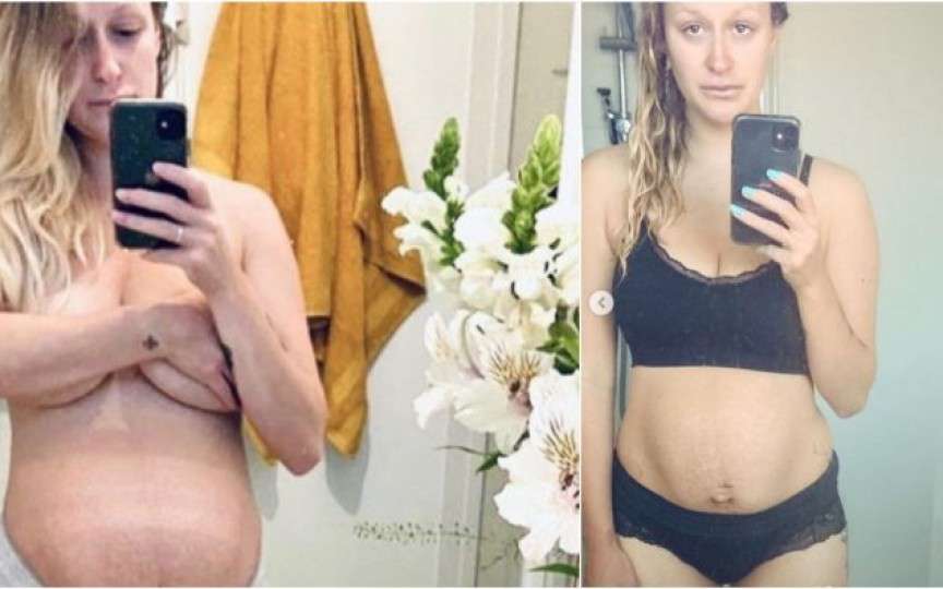 Confesiunea dureroasă a unei mame: Nimeni nu te pregătește pentru perioada postpartum după o pierdere de sarcină