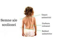 3 exerciții fizice care pot corecta scolioza la copii