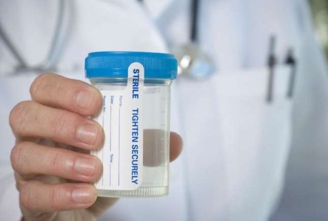 Descifrarea testului de urină și ce probleme se pot identifica astfel