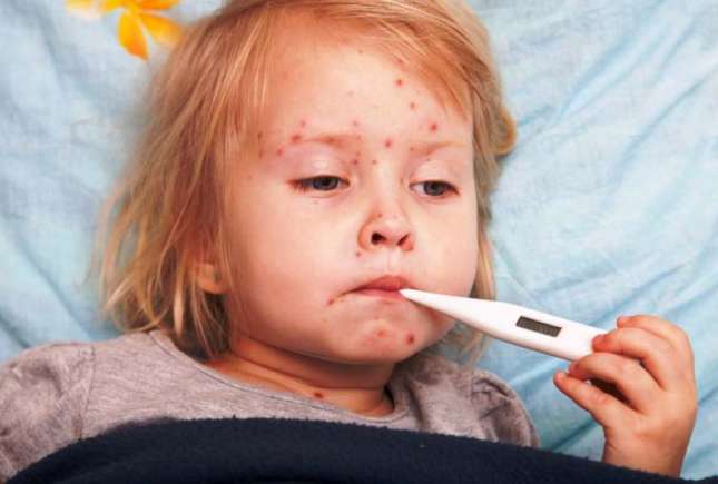 Boala bubelor dulci: cât de contagioasă este și cum se tratează