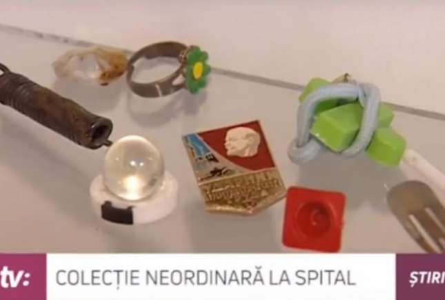 Colecție curioasă la Institutul Mamei și Copilului: obiecte înghițite de copii