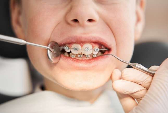 Legătura dintre alinierea dentară și postura corpului la copii