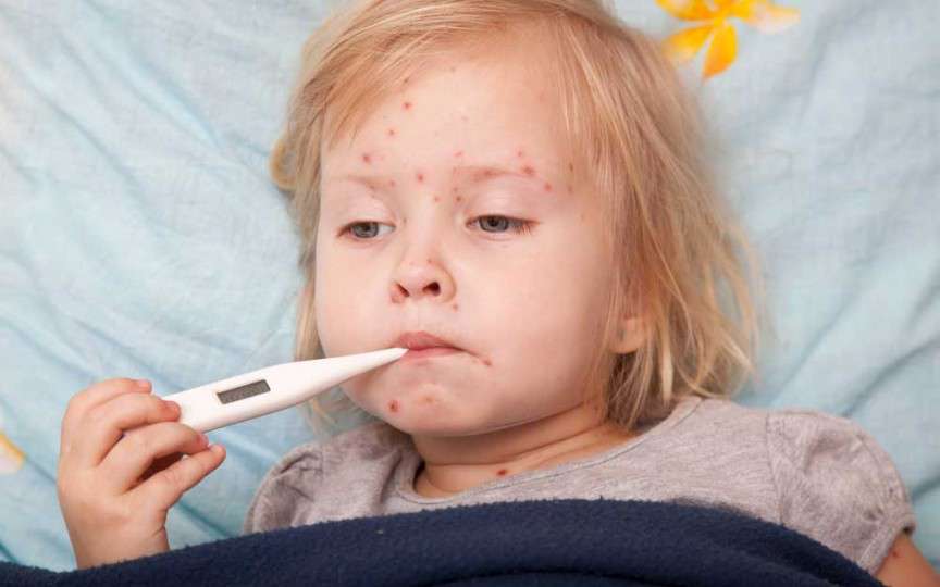 Rujeola a trecut Prutul? Află care sunt simptomele infecției!