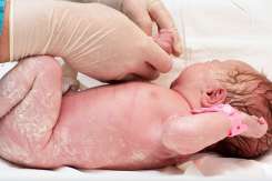 Vernix caseosa: Ce este și cum protejează bebelușul în primele zile de viață