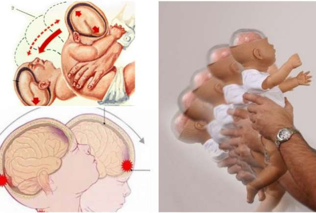Medic neonatolog: Se atestă o creștere a cazurilor de sindrom al copilului zgâlțâit