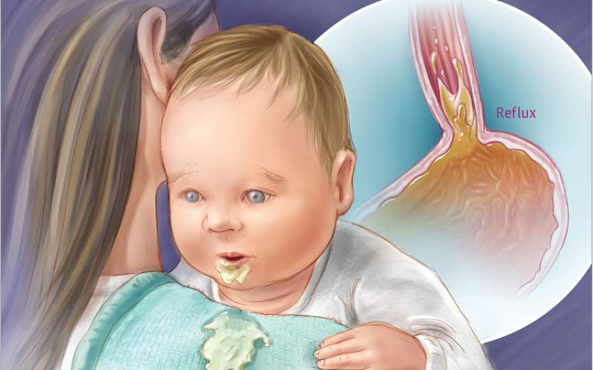 Medic pediatru: 99% dintre colegii mei pun prea ușor diagnosticul de reflux la bebeluși, iar medicamentele sunt riscante