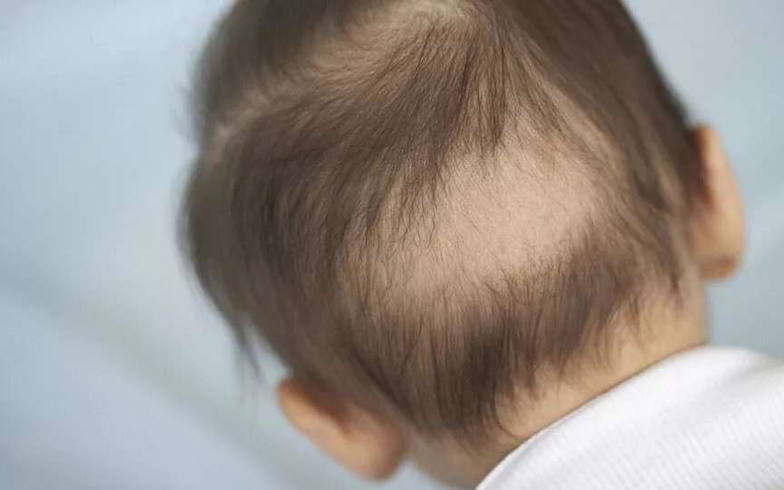 Căderea părului la bebeluși: De ce apare și cum poți îngriji scalpul micuțului