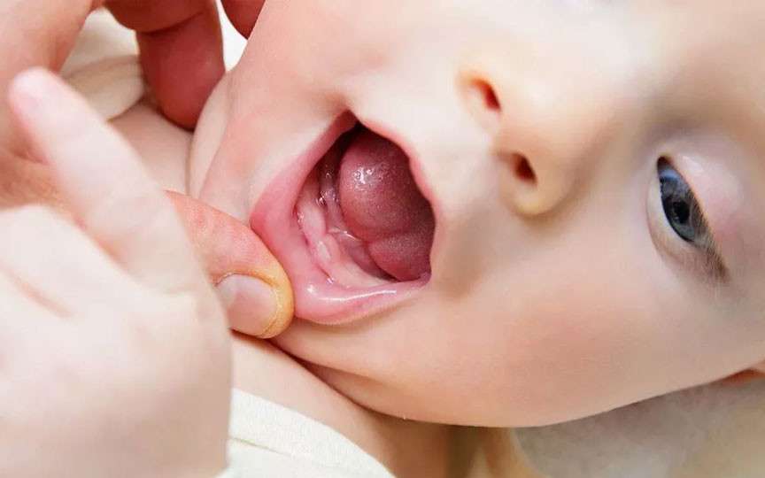 Eruptia dentară la bebeluși: simptome, ordine și sfaturi de la medicul stomatolog