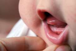 7 semne că apar primii dinţişori la bebeluș