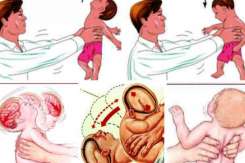 Medic neurolog-pediatru: Zgâlțâitul bebelușului are efecte asemănătoare impactului pe care îl suferă un adult în timpul unui accident de mașină