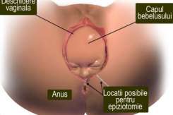 Expulzia fătului în timpul nașterii – când avem nevoie de epiziotomie