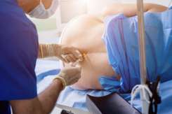 Cum să decizi dacă epidurala este potrivită pentru tine și care sunt riscurile acesteia