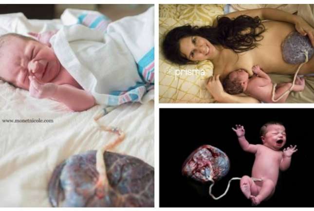 Imagini care au făcut înconjurul lumii: bebeluși și placentele lor