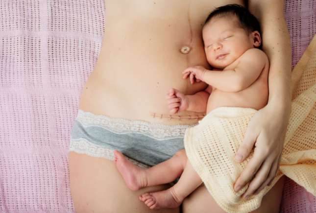 11 probleme frecvente care pot apărea după nașterea prin cezariană