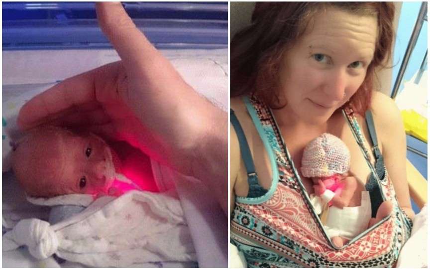 Un medic a reușit să salveze un nou-născut de numai 500 de grame