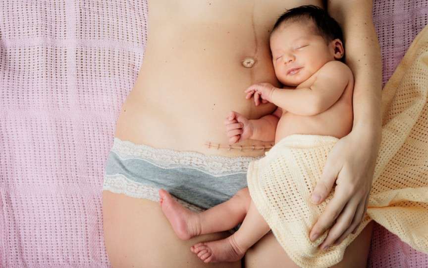 11 probleme frecvente care pot apărea după nașterea prin cezariană