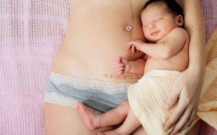 O femeie vorbește despre 13 lucruri la care nu se aștepta după cezariană