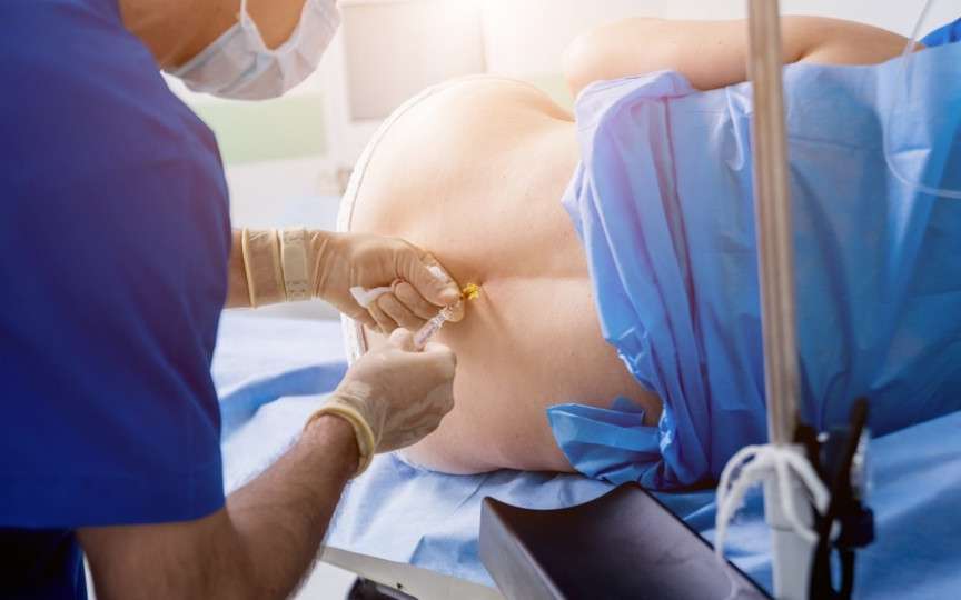 Cum să decizi dacă epidurala este potrivită pentru tine și care sunt riscurile acesteia