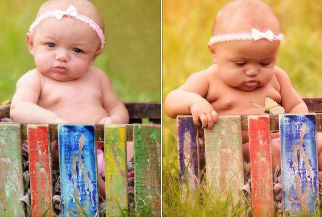 Află istoria gemenelor născute cu pielea de culoare diferită