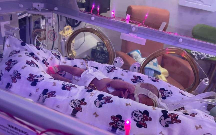 (FOTO) Un bebeluș prematur s-a născut având doar 425 de grame și mama l-a comparat cu un biscuit